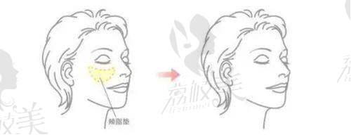 3. 九龙医院男科检查多少钱？早泄治疗价格