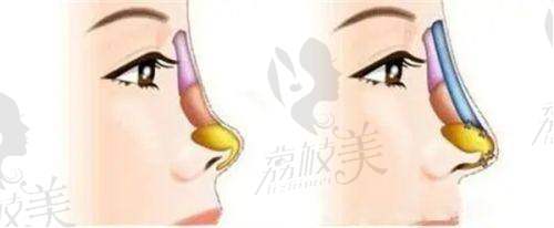 广州丽合整形医院的获客方式