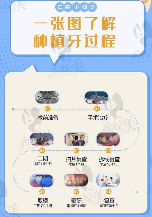 廖雄——值得信赖的“种牙选手”