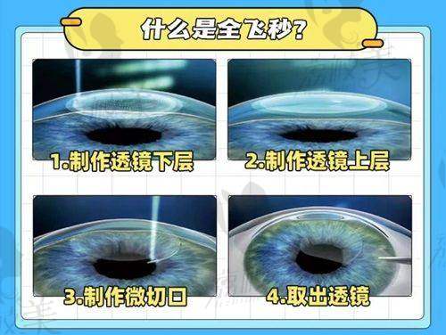 桂林爱尔眼科医院怎么样？