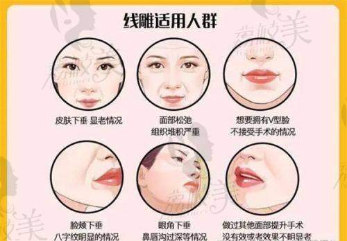 术后护理也讲究，这里的辅助服务不简单