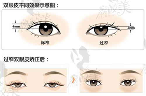 北京米兰柏羽丽都医疗美容做眼睛好医生名单：曹卫华医生介绍
