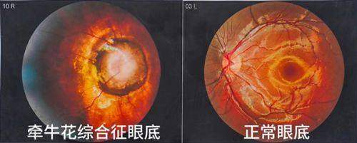 桂林爱尔眼科医院怎么预约挂号？
