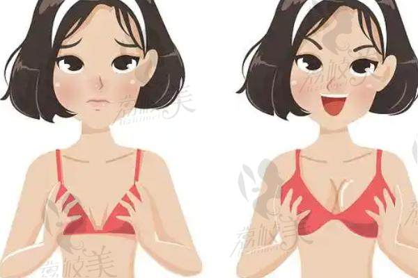 2. 不同隆胸项目及品牌价格