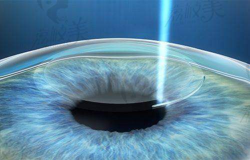 武汉同济医院眼科挂号预约全流程公布：华中地区知名眼科专家坐诊，蔡司VisuMax3.0设备精准诊疗