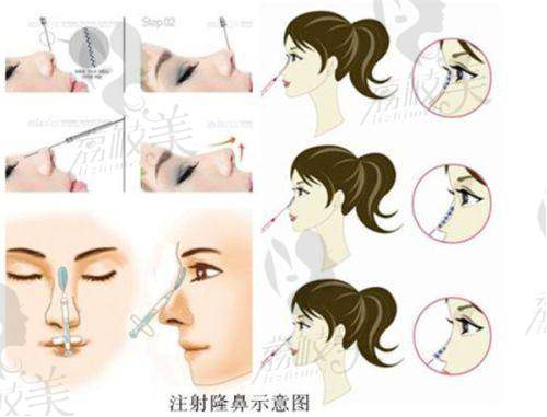 昆山星容妍医疗美容诊所口碑怎么样？