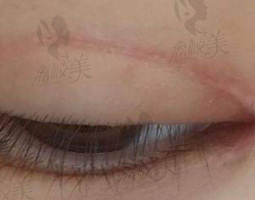 审美精细型——精细化雕刻细琢的艺术家于晓春
