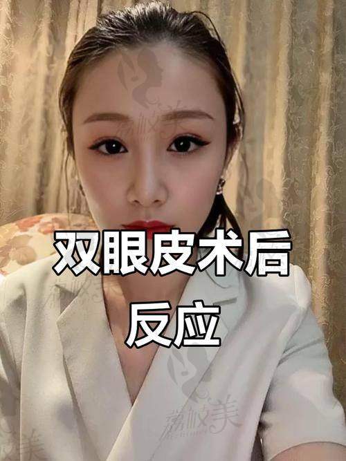 典型实例:死板假宽+肉条感,一次修复回归自然小扇形