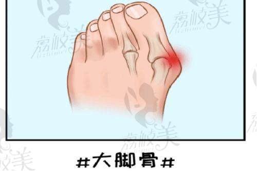 濡白天使适合打什么部位？揭秘常见注射部位及效果，为你的美容选择提供参考！