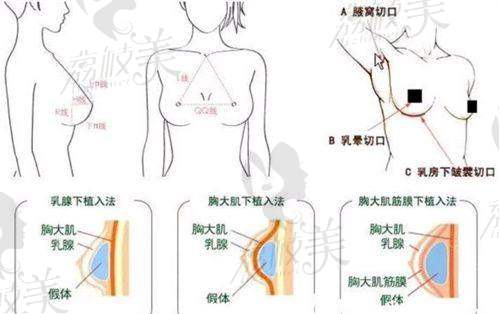 淄博美冠臣医疗美容医院价格表：