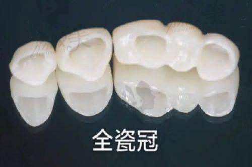 三、惠州德伦口腔医院医生介绍: