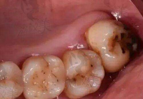 包头京卓口腔门诊部预约电话181***7789，专业团队高性价比护您口腔健康 