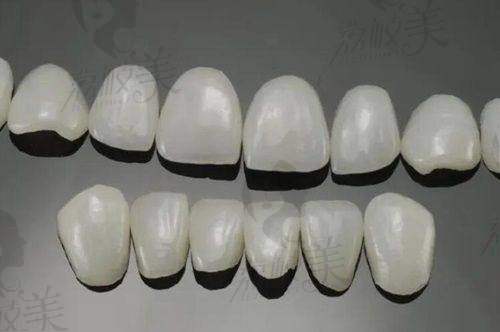 曲靖卓美口腔门诊部靠谱吗？本土连锁医保定点，补牙99元起，附医生团队介绍