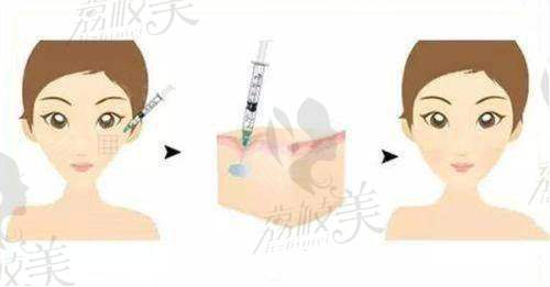 心动不如行动：快来体验西安大爱医院张国孝提眉手术