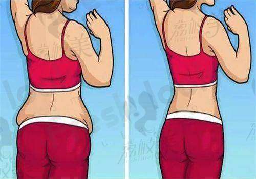 韩国医美必看！首尔江南核心区两大减重/抽脂医院权威全攻略