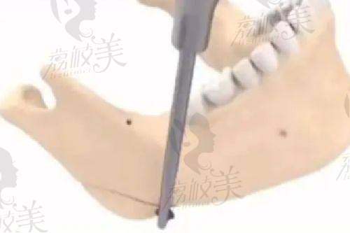 提眉项目价格优势