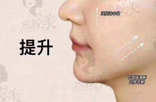 成都春天整形医院周斌珊瑚骨精微提:价格亲民的变得更美魔法