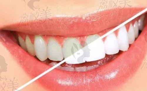 五、深圳正恩口腔门诊部红山形象院基本信息: