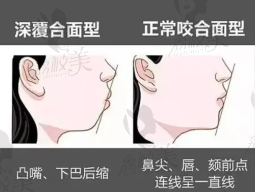 营口西市瑞宁口腔怎么样？3D数字CT+3D打印技术，技术口碑双优，附分院信息 