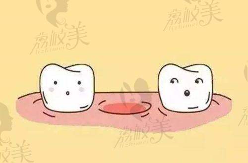 担心宜昌看牙踩坑？咿呀中广口腔：正规资质 + 透明价（种牙 2500 起），附地址交通