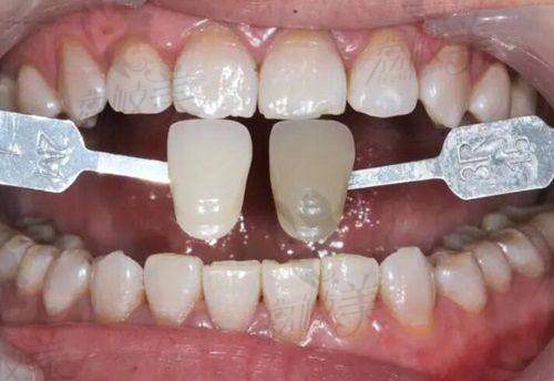 深圳侨城菲诺口腔全攻略：2000㎡规模 + 骨干医生团队，预约电话及诊疗项目一览