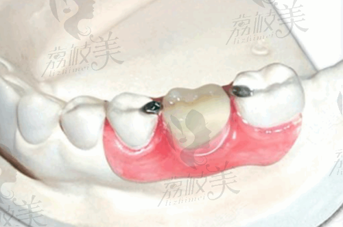 集士港牙科医院哪家比较好？佳博、一诺口腔优势多，技术强服务优项目全 