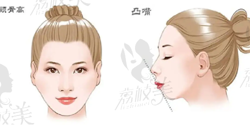 深圳曹孟君医生在吸脂领域的口碑和评价怎么样？