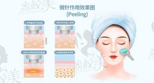 医美界大揭秘！邓璐雯跟蒲翠玲谁厉害？全方位对比一探究竟！ 