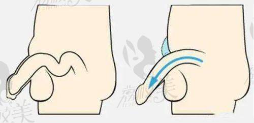 西宁澳丽医疗美容余红敏双眼皮整形的便捷位置