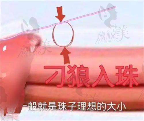 沈阳百嘉丽整形医院好不好？正规靠谱、技术优、服务佳获众多好评