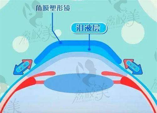 广州医科大学附属第五医院眼科收费标准公布啦！全飞秒 1.6 万，价格透明无二次收费 