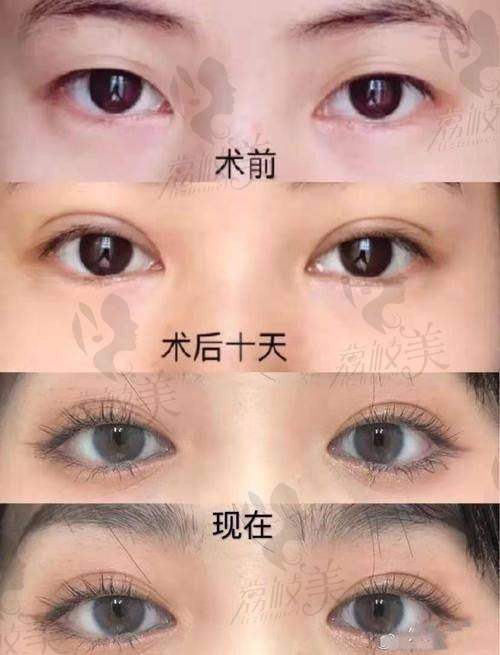 杨胤恒医生个人资料简介：