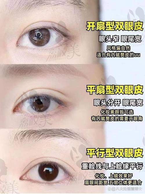 术后修复过程有多快？看看蔡灵打造的普通全切修复曲线