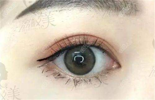 王剑医生技术特点：