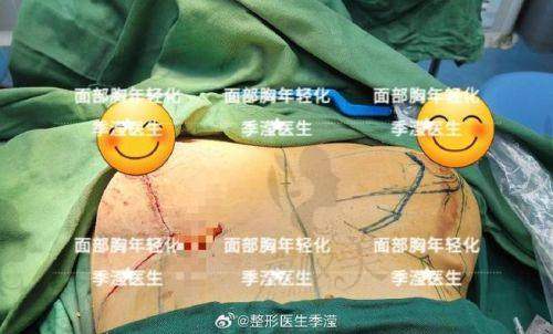 成都春天整形医院周斌:实力医生,值得信赖
