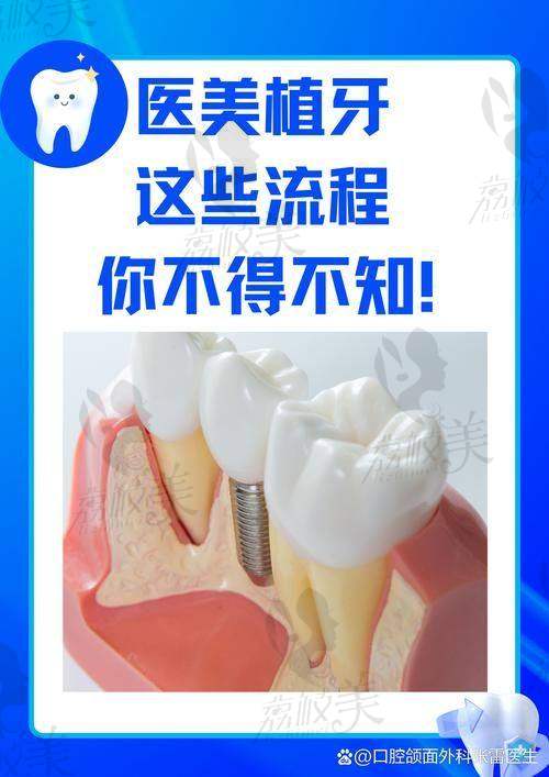 深圳中环口腔曾景量做韩国奥齿泰种植牙的口碑