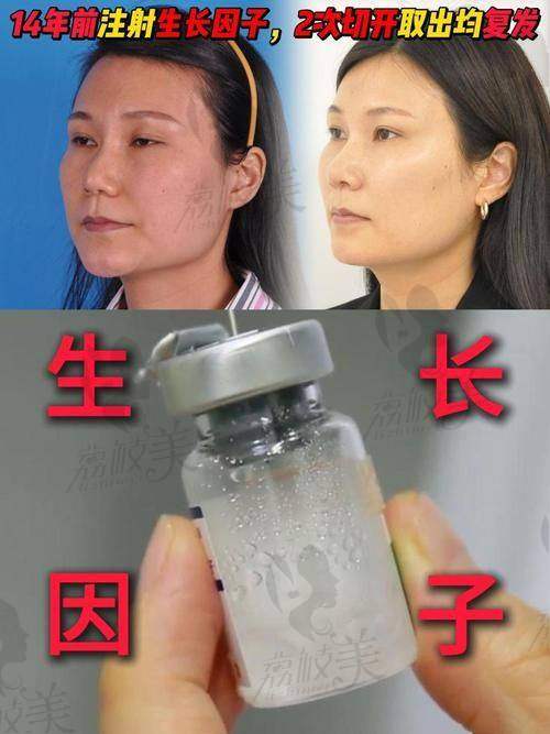 北京取生长因子正规有资质的医院有哪些？这篇攻略给你答案！