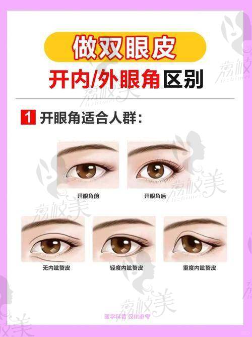 上海眼王张宇医生的真实评价如下