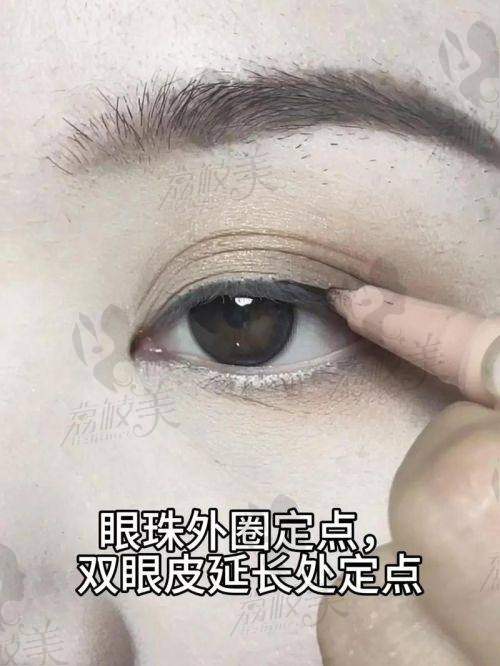 上海眼王张宇医生在哪家医院？