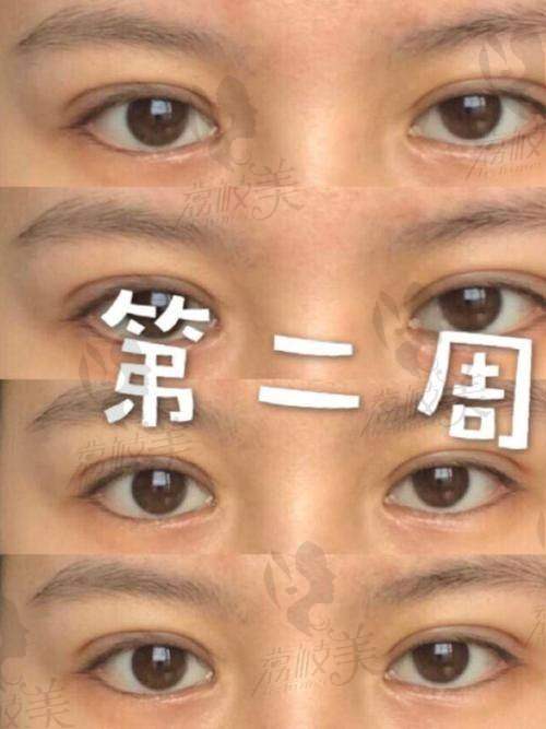 上海眼王张宇医生怎么预约？