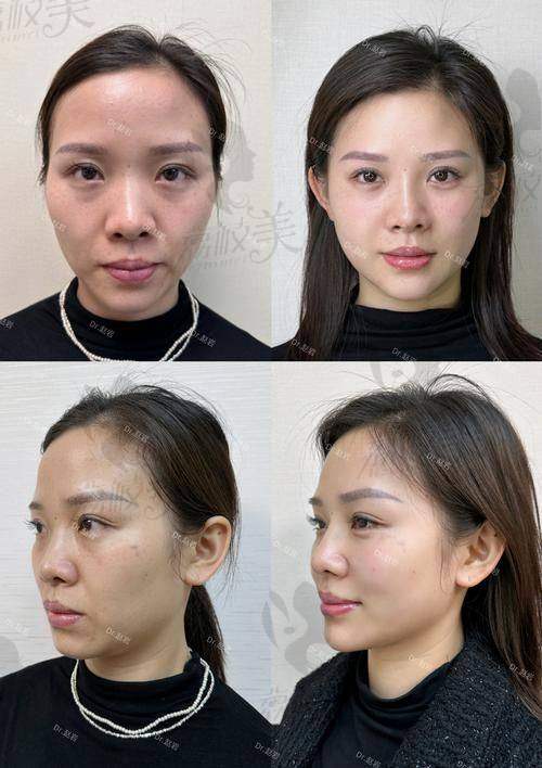 怎么预约杨胤恒医生？及术前术后注意事项