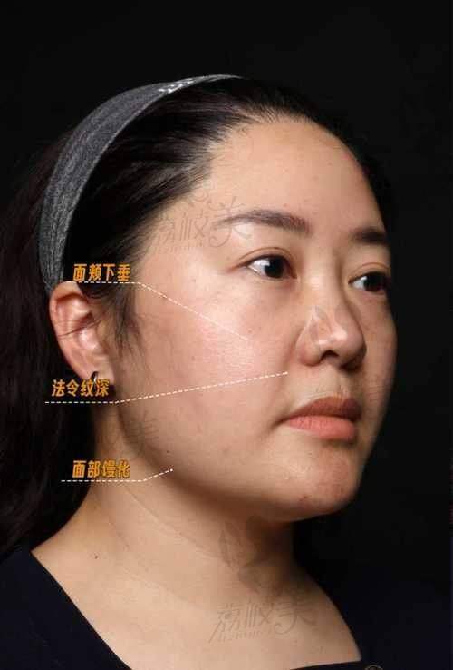 上海杨胤恒医生值得信赖吗？他的口碑来自高超手法与高满意度