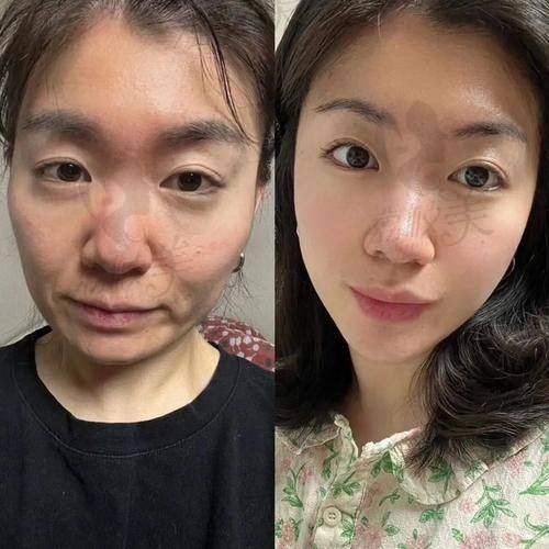 成都春天整形医院周斌珊瑚骨精微提:优势特色大揭秘