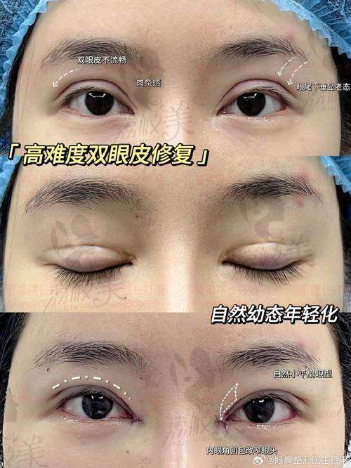 王剑医生口碑怎么样？