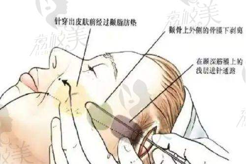 南华大学附属第一医院医疗美容科特色项目: