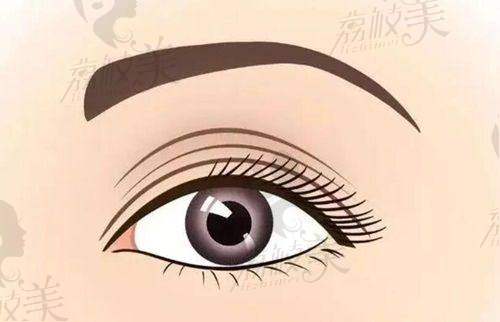 郑州王剑医生修复双眼皮价格大公开，项目分项明细请掌握