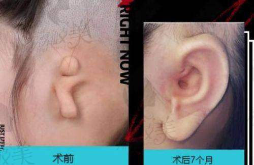 南华大学附属第一医院医疗美容科口碑怎么样?