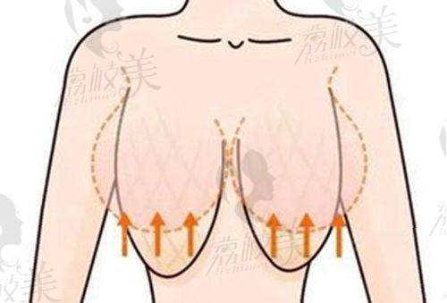 刘平眼部修复靠谱不?上海颜净医疗美容门诊部技术精湛，疤痕淡化效果显著