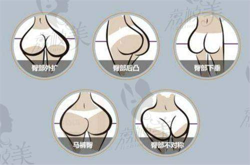 整容医院在线咨询免费24h在线解答：美莱整形医生团队专业，3D立体设计打造自然美眸