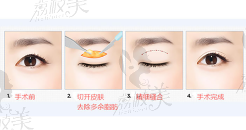 北京协和医院电话咨询24小时热线：整形修复专家在线答疑，AI规划吸脂路径误差小于0.3毫米